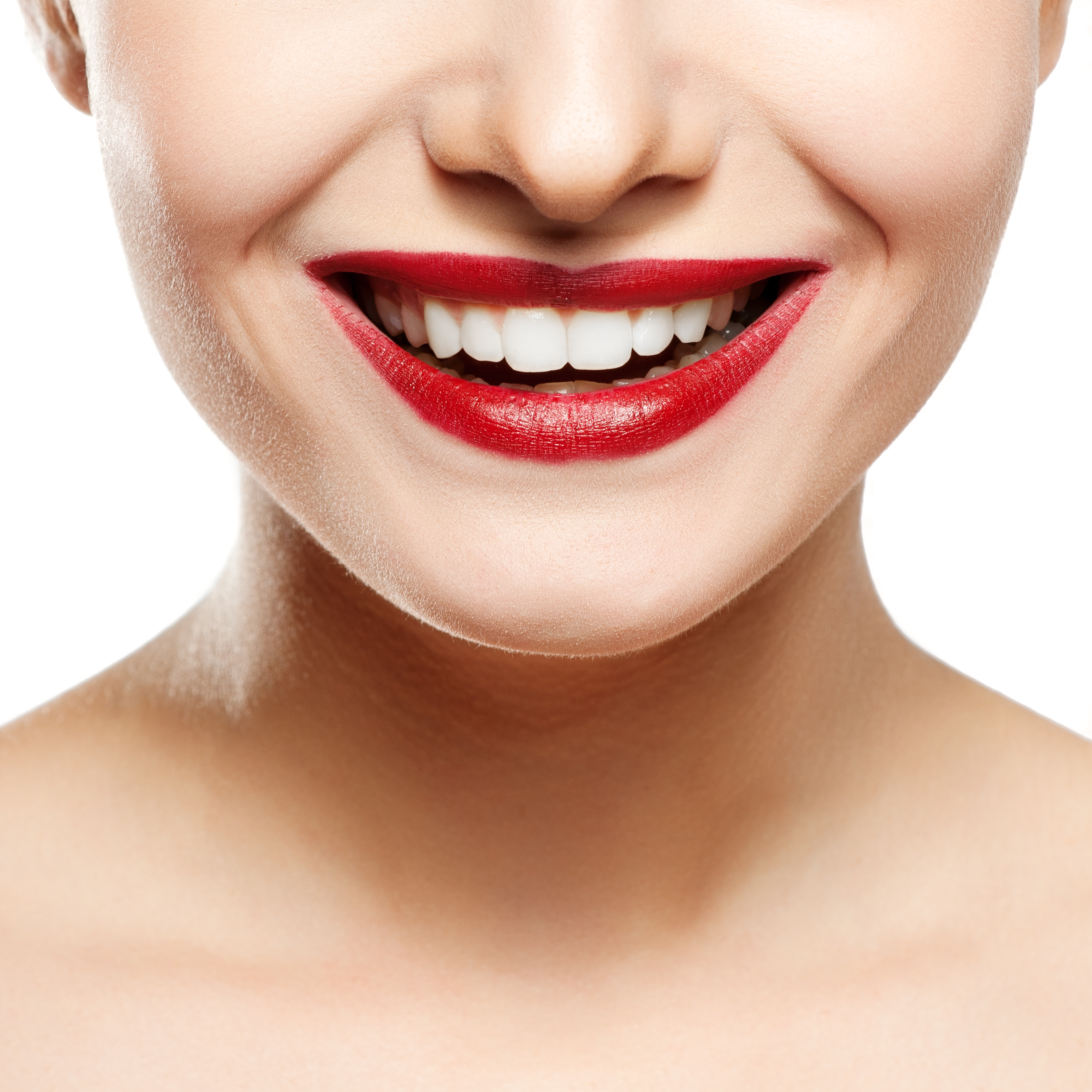 faccette dentali